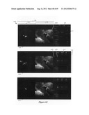 Color waveform diagram and image