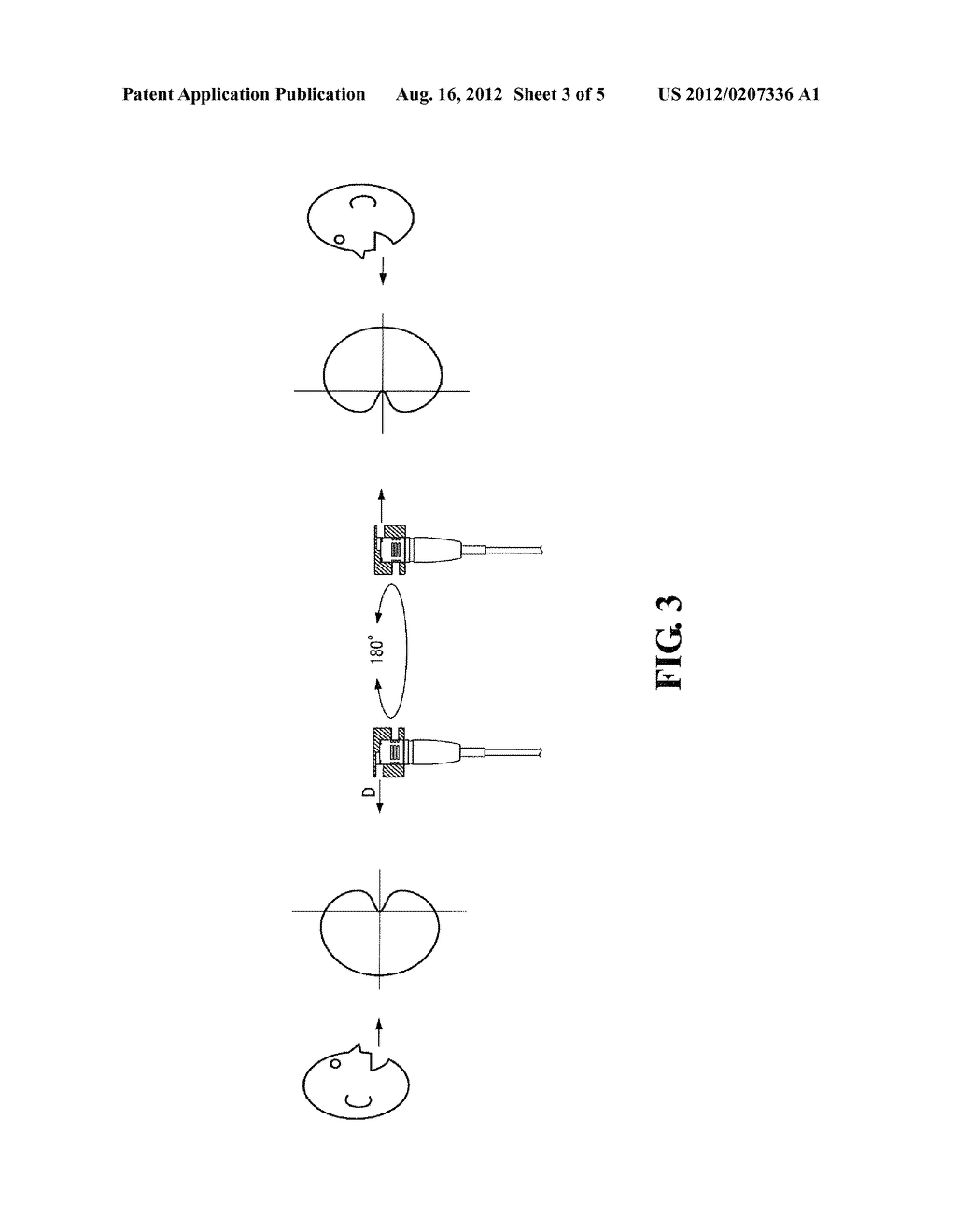 Microphone Cap and Microphone - diagram, schematic, and image 04