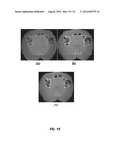 Systems and Methods for Simultaneous Acquisition of Scatter and Image     Projection Data in Computed Tomography diagram and image