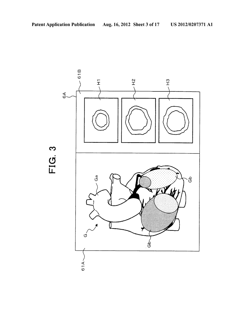 MEDICAL IMAGE PROCESSING APPARATUS AND MEDICAL IMAGE DIAGNOSIS APPARATUS - diagram, schematic, and image 04