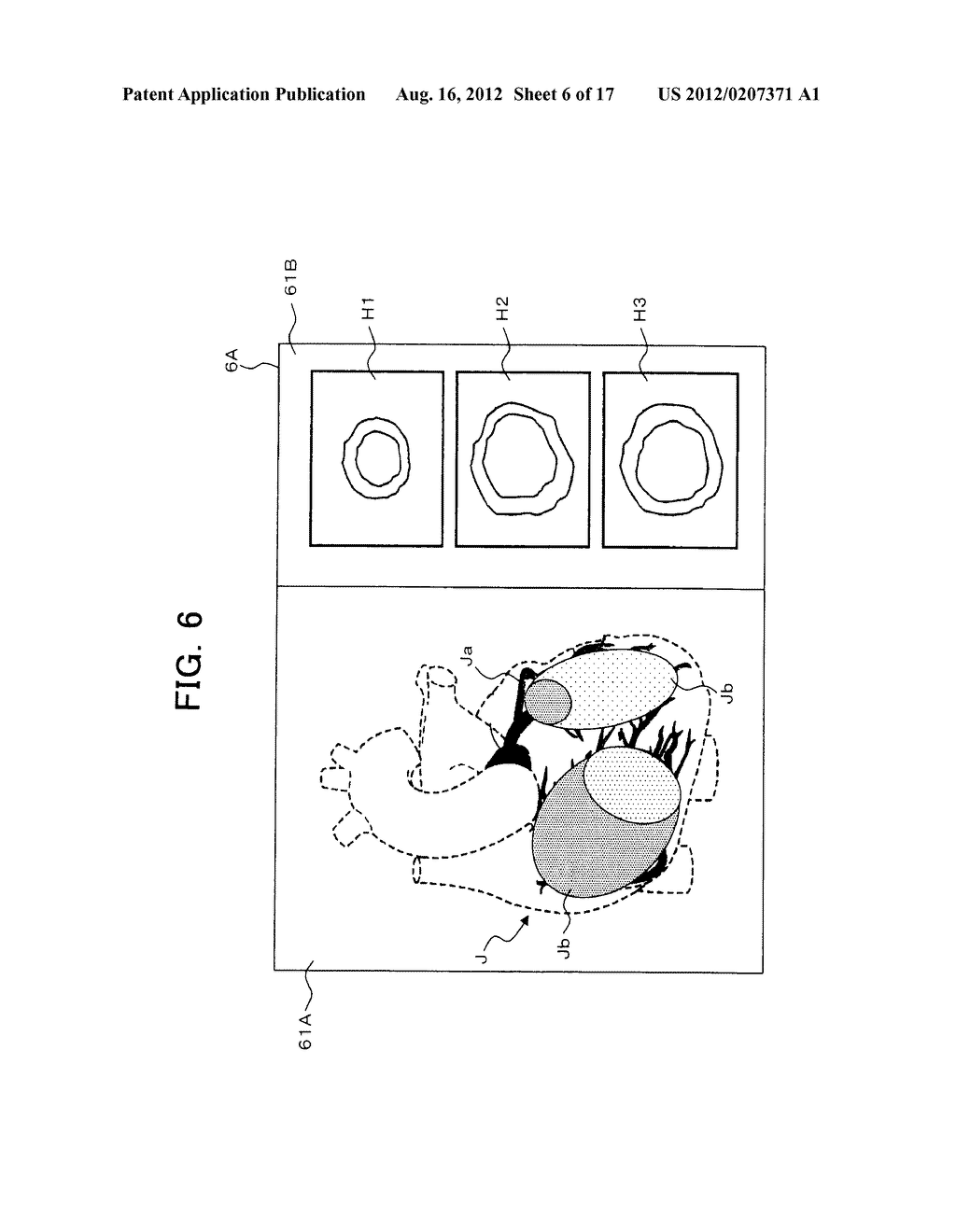 MEDICAL IMAGE PROCESSING APPARATUS AND MEDICAL IMAGE DIAGNOSIS APPARATUS - diagram, schematic, and image 07