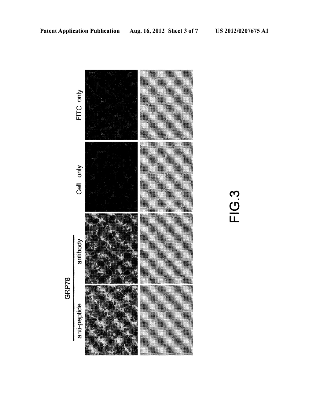 Method of Colorectal Cancer Detection by Using Radiolabeled Anti-GRP78     Peptide - diagram, schematic, and image 04