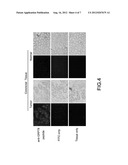 Method of Colorectal Cancer Detection by Using Radiolabeled Anti-GRP78     Peptide diagram and image