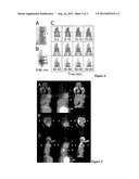 NEUROTENSIN ANALOGUES FOR RADIOISOTOPE TARGETING TO NEUROTENSIN     RECEPTOR-POSITIVE TUMORS diagram and image