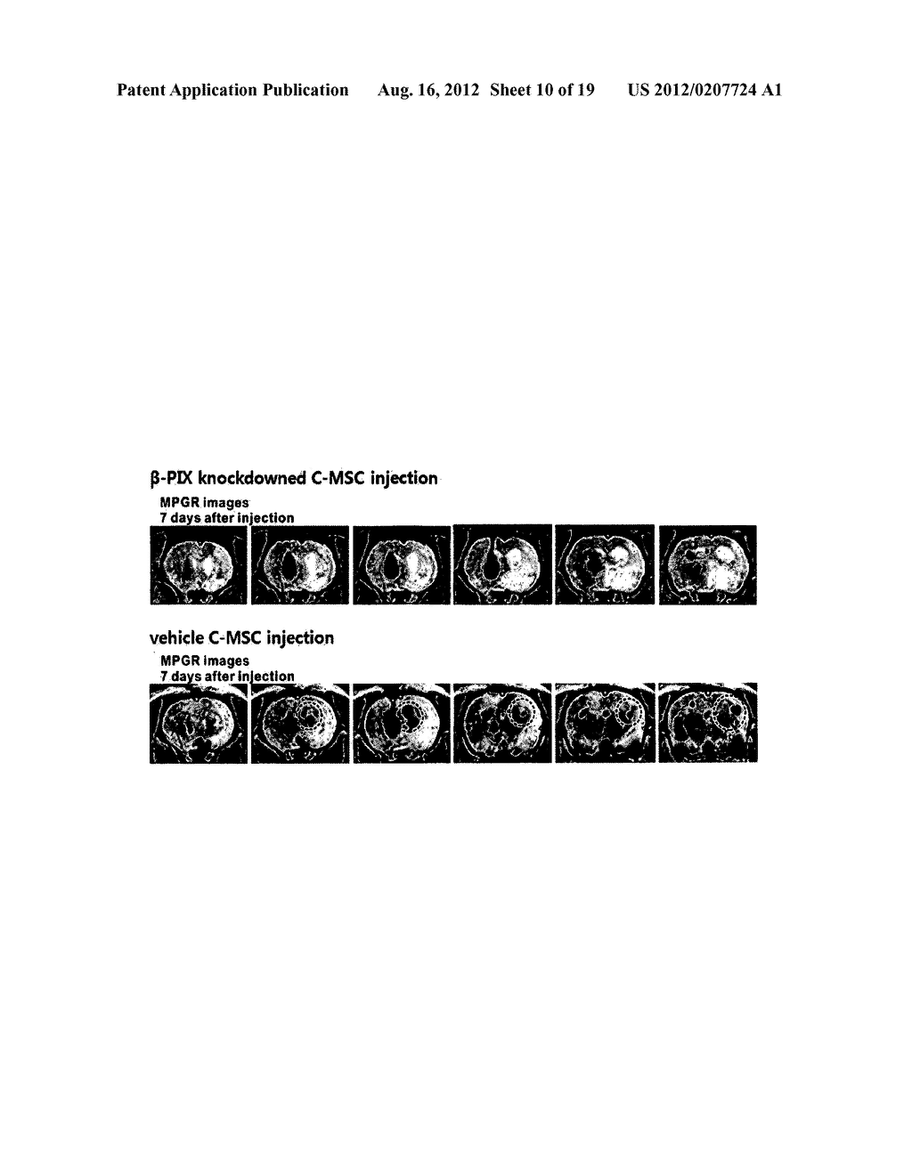 Compositions for Improving Migration Potential of Stem Cells - diagram, schematic, and image 11