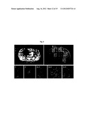 Compositions for Improving Migration Potential of Stem Cells diagram and image