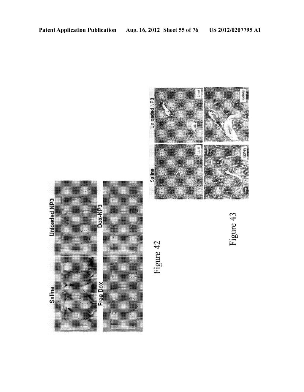 CATIONIC POLYMER COATED MESOPOROUS SILICA NANOPARTICLES AND USES THEREOF - diagram, schematic, and image 56