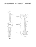 DEVICES AND METHODS FOR TREATING DEFECTS IN THE TISSUE OF A LIVING BEING diagram and image