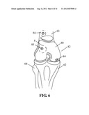 DEVICES AND METHODS FOR TREATING DEFECTS IN THE TISSUE OF A LIVING BEING diagram and image