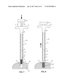 DEVICES AND METHODS FOR TREATING DEFECTS IN THE TISSUE OF A LIVING BEING diagram and image