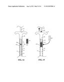 DEVICES AND METHODS FOR TREATING DEFECTS IN THE TISSUE OF A LIVING BEING diagram and image