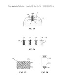 DEVICES AND METHODS FOR TREATING DEFECTS IN THE TISSUE OF A LIVING BEING diagram and image