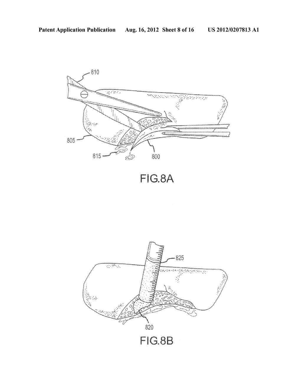 RAPIDLY ACTING DRY SEALANT AND METHODS FOR USE AND MANUFACTURE - diagram, schematic, and image 09