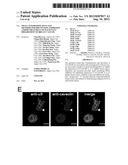 SMALL INTERFERING RNAS AND METHODS FOR PREVENTION, INHIBITION AND/OR     TREATMENT OF MALIGNANT PROGRESSION OF BREAST CANCER diagram and image