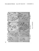 SMALL INTERFERING RNAS AND METHODS FOR PREVENTION, INHIBITION AND/OR     TREATMENT OF MALIGNANT PROGRESSION OF BREAST CANCER diagram and image