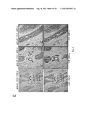 SMALL INTERFERING RNAS AND METHODS FOR PREVENTION, INHIBITION AND/OR     TREATMENT OF MALIGNANT PROGRESSION OF BREAST CANCER diagram and image