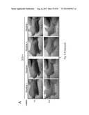 SMALL INTERFERING RNAS AND METHODS FOR PREVENTION, INHIBITION AND/OR     TREATMENT OF MALIGNANT PROGRESSION OF BREAST CANCER diagram and image