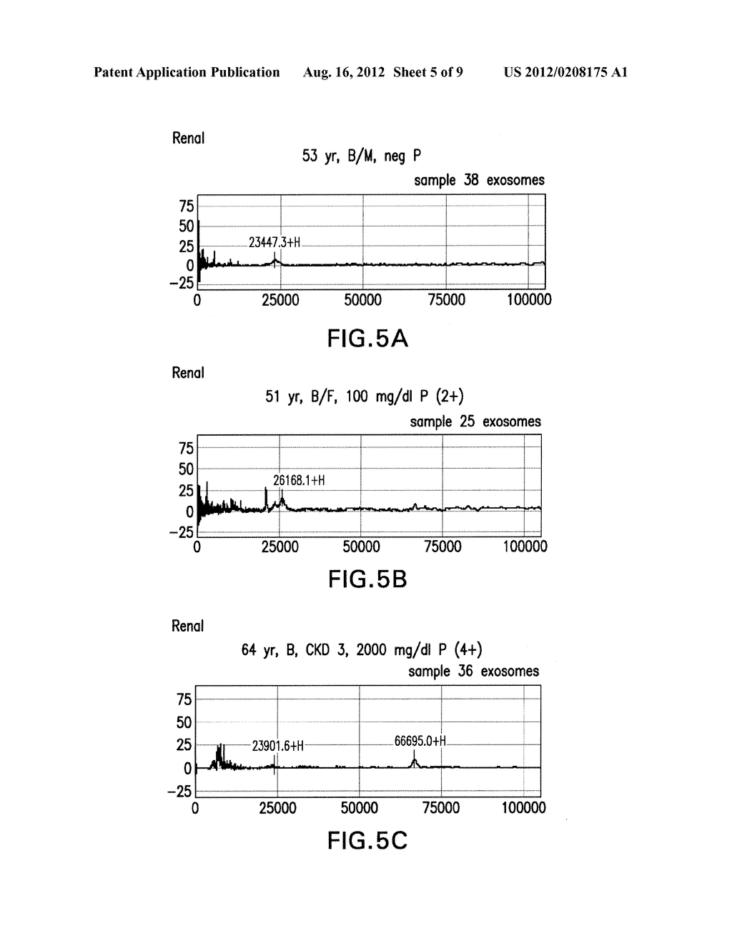 DETECTION OF HIV-RELATED PROTEINS IN URINE - diagram, schematic, and image 06