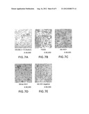 DETECTION OF HIV-RELATED PROTEINS IN URINE diagram and image