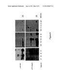 DETECTION OF HIV-RELATED PROTEINS IN URINE diagram and image