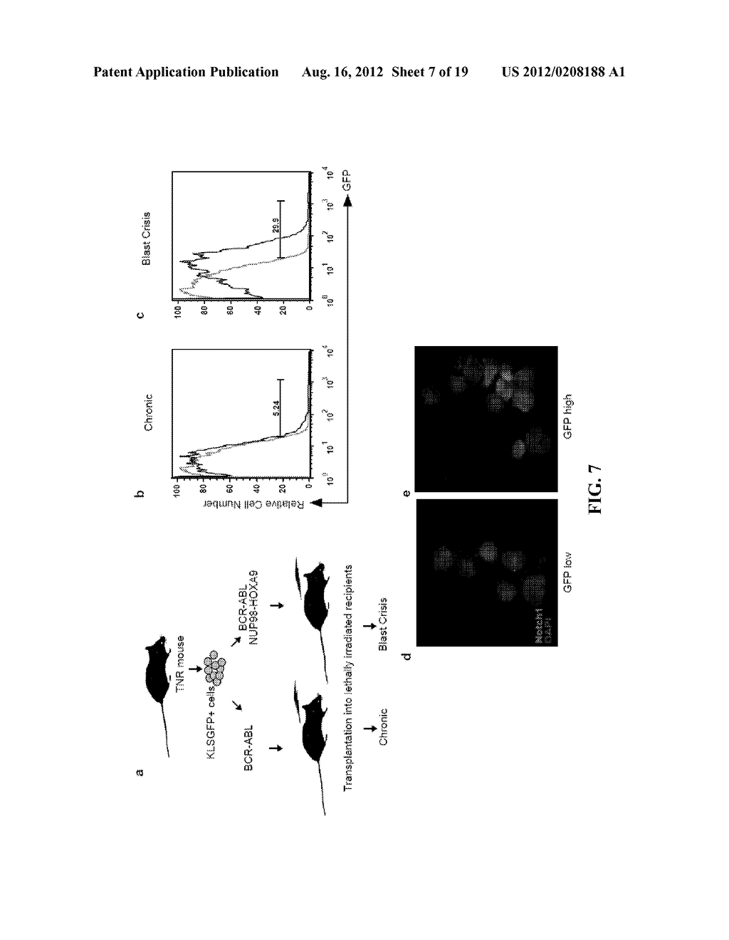 DIAGNOSTIC AND TREATMENT FOR CHRONIC AND ACUTE PHASE MYELOID LEUKEMIA - diagram, schematic, and image 08