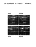 METHODS FOR DETECTING PRE-DIABETES AND DIABETES USING DIFFERENTIAL PROTEIN     GLYCOSYLATION diagram and image