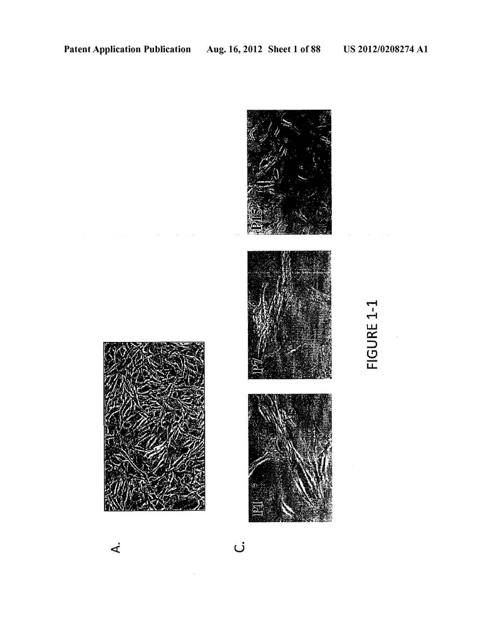 ADIPOSE-DERIVED STEM CELLS AND LATTICES - diagram, schematic, and image 02