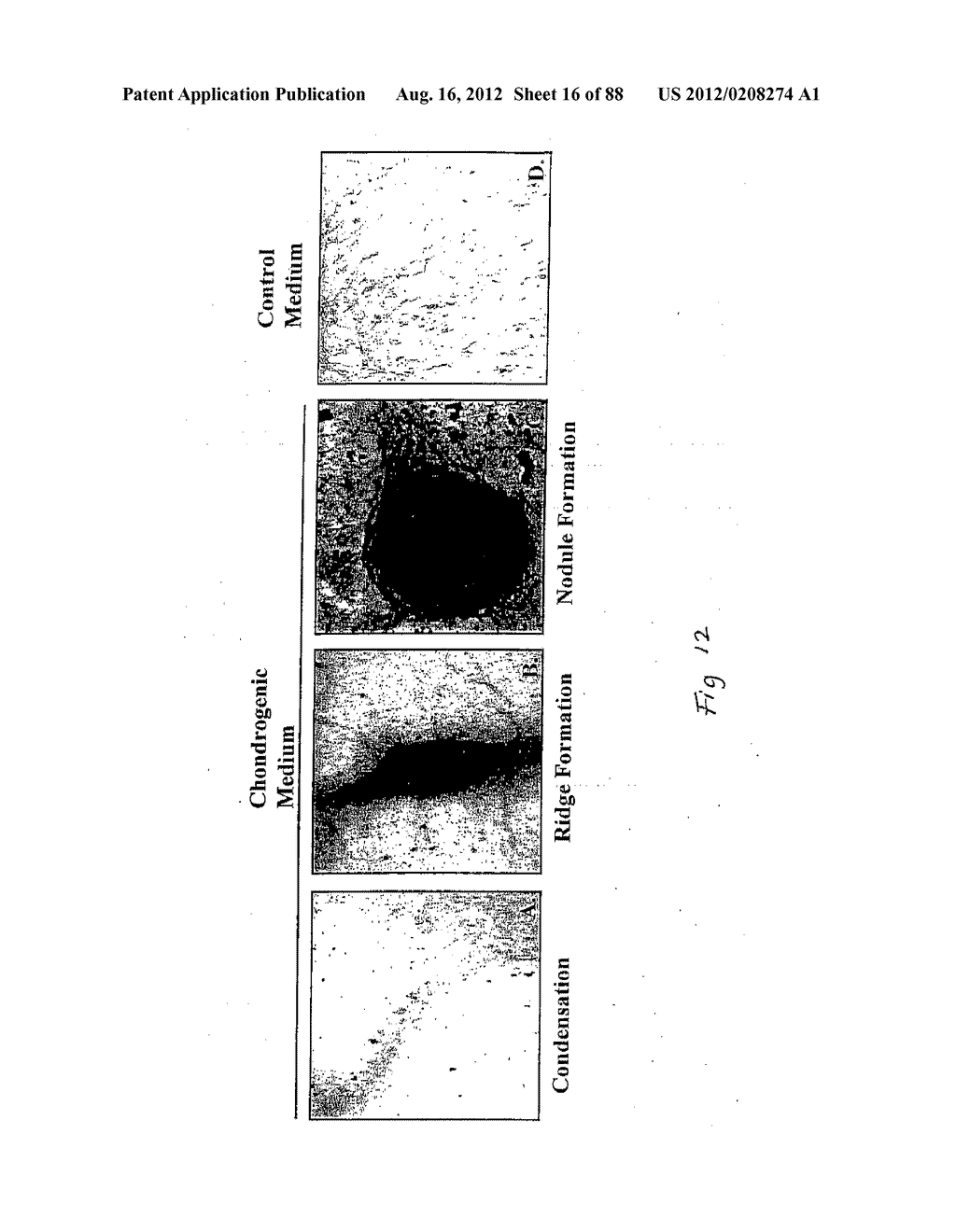 ADIPOSE-DERIVED STEM CELLS AND LATTICES - diagram, schematic, and image 17