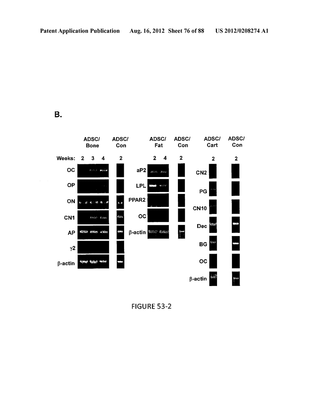 ADIPOSE-DERIVED STEM CELLS AND LATTICES - diagram, schematic, and image 77