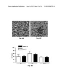 Carcinoma Homing Peptide (CHP), Its Analogs, and Methods of Using diagram and image