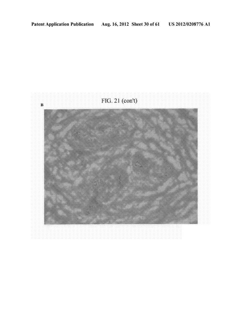 ANTI-NEOPLASTIC COMPOSITIONS COMPRISING EXTRACTS OF BLACK COHOSH - diagram, schematic, and image 31