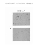 ANTI-NEOPLASTIC COMPOSITIONS COMPRISING EXTRACTS OF BLACK COHOSH diagram and image