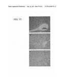 ANTI-NEOPLASTIC COMPOSITIONS COMPRISING EXTRACTS OF BLACK COHOSH diagram and image