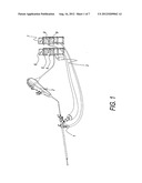 MOTHER-BABY ENDOSCOPE SYSTEM CONSISTING OF HARD MOTHER-CHOLECYSTOSCOPE AND     FLEXIBLE BABY-CHOLEDOCHOSCOPE diagram and image