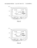 SYSTEM AND METHODS FOR PROCESSING ANALYTE SENSOR DATA diagram and image