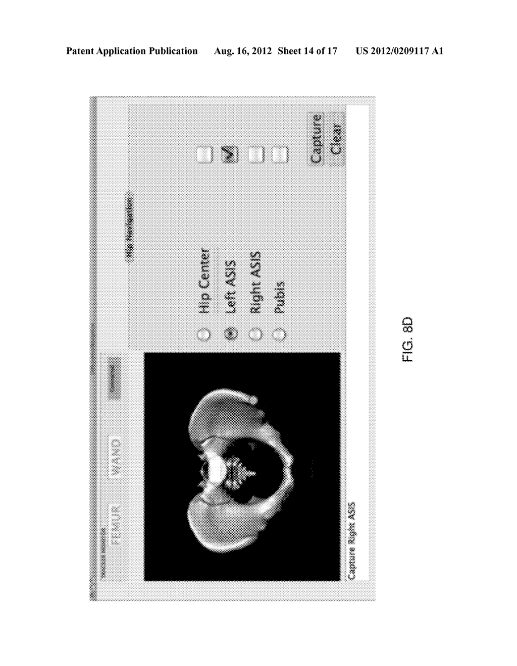 Surgical Measurement Apparatus and System - diagram, schematic, and image 15