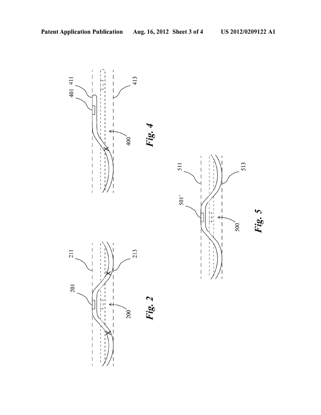 Shape-Controllable Catheters and Catheter System - diagram, schematic, and image 04