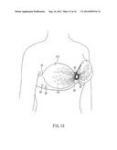 BREAST HEALTH CARE DEVICE diagram and image
