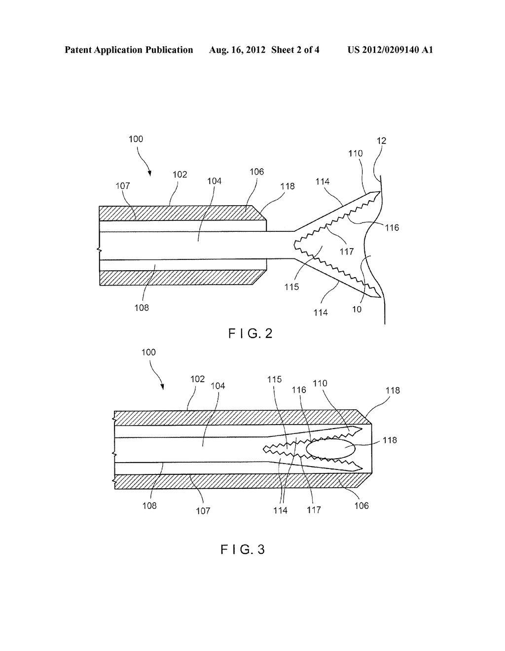 Tissue Sampling Device - diagram, schematic, and image 03