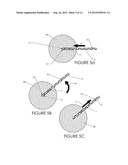 TISSUE REMOVAL DEVICE AND METHOD OF USE diagram and image