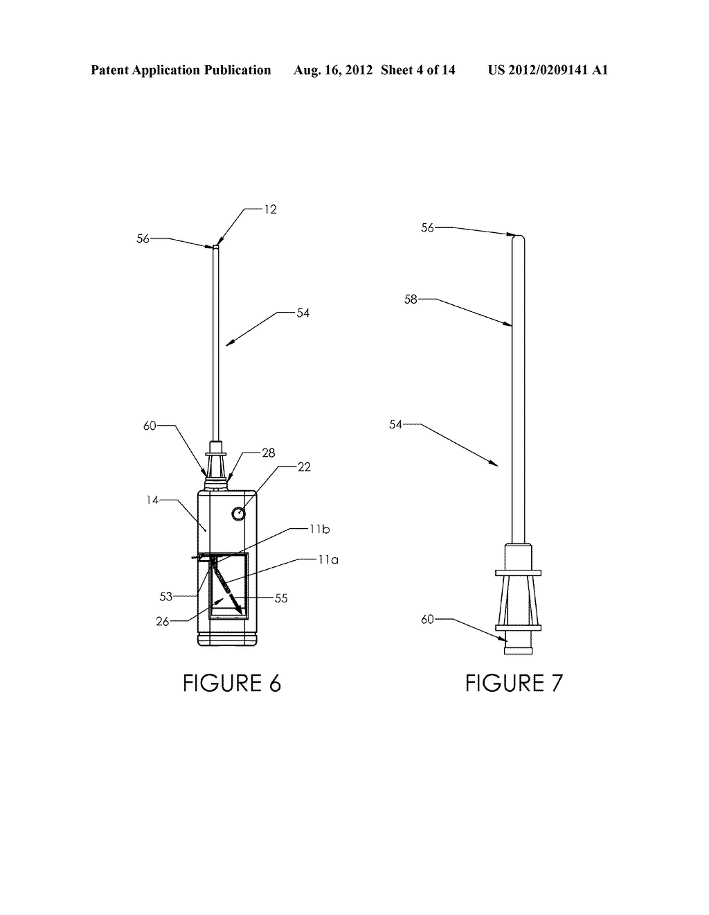 TISSUE REMOVAL DEVICE AND METHOD OF USE - diagram, schematic, and image 05