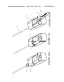 TISSUE REMOVAL DEVICE AND METHOD OF USE diagram and image