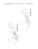 TISSUE REMOVAL DEVICE AND METHOD OF USE diagram and image