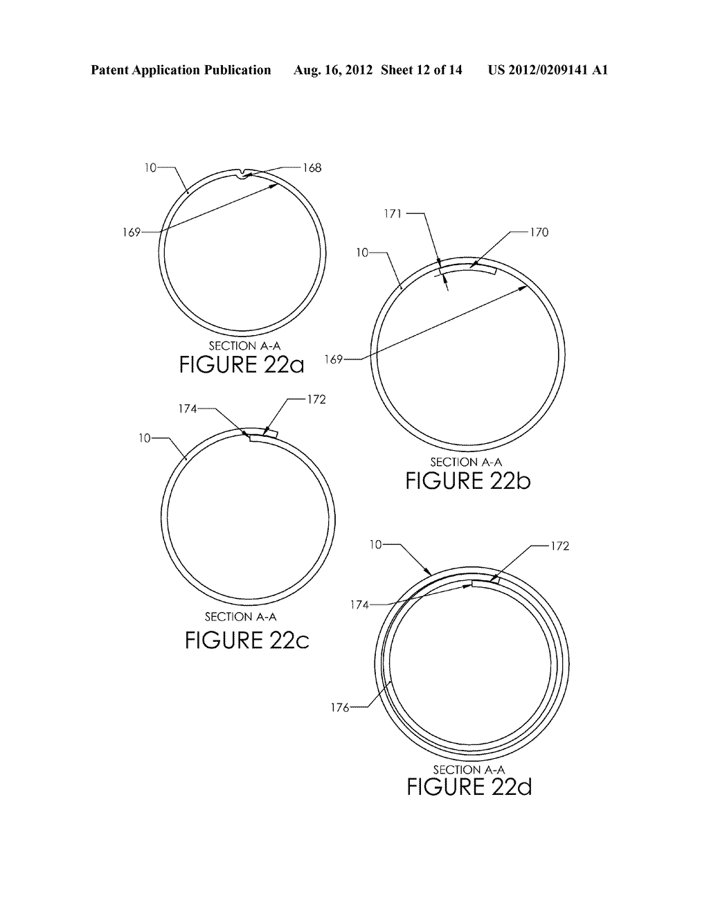 TISSUE REMOVAL DEVICE AND METHOD OF USE - diagram, schematic, and image 13