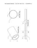 TISSUE REMOVAL DEVICE AND METHOD OF USE diagram and image