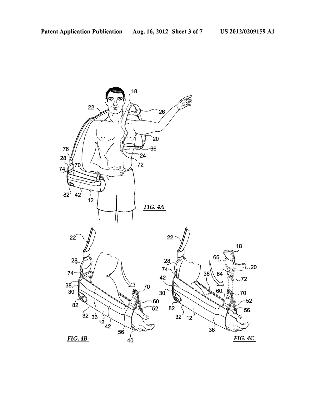 SHOULDER ORTHOSIS HAVING A SUPPORTIVE STRAPPING SYSTEM - diagram, schematic, and image 04