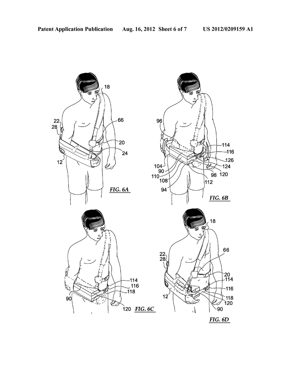SHOULDER ORTHOSIS HAVING A SUPPORTIVE STRAPPING SYSTEM - diagram, schematic, and image 07