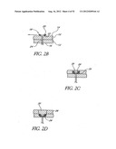 Methods of replacing a gastrointestinal bypass sleeve for therapy     adjustment diagram and image