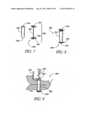 Methods of replacing a gastrointestinal bypass sleeve for therapy     adjustment diagram and image