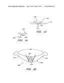 Methods of replacing a gastrointestinal bypass sleeve for therapy     adjustment diagram and image